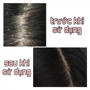 Dầu gội Medimix Sạch Gàu & Liệu Pháp Da Đầu 400ml